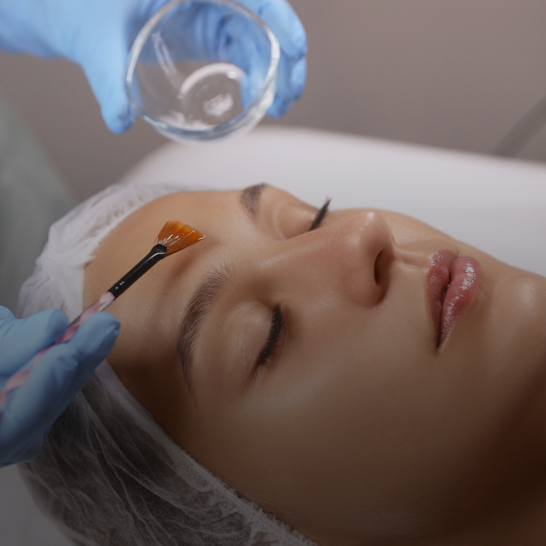 Age Erasing Chemical Peel Facial